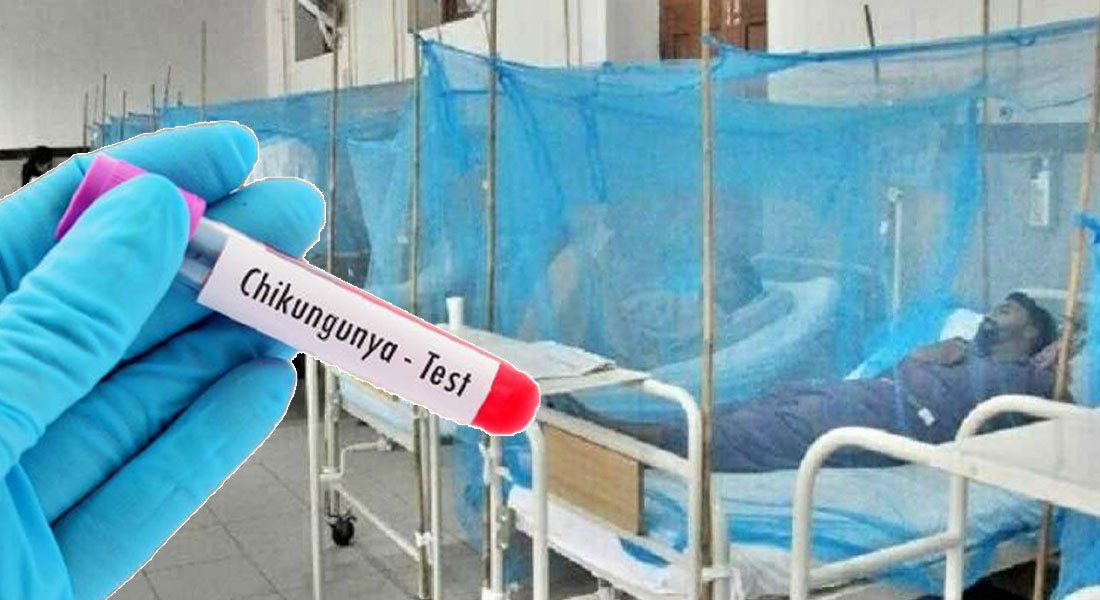 Chikungunya