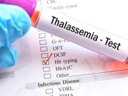 thalassaemia tests grooms