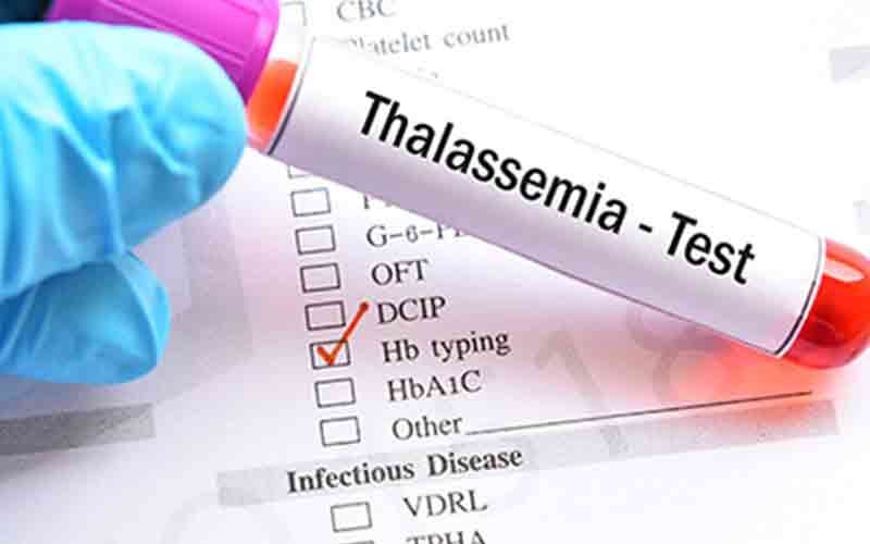 thalassaemia tests grooms